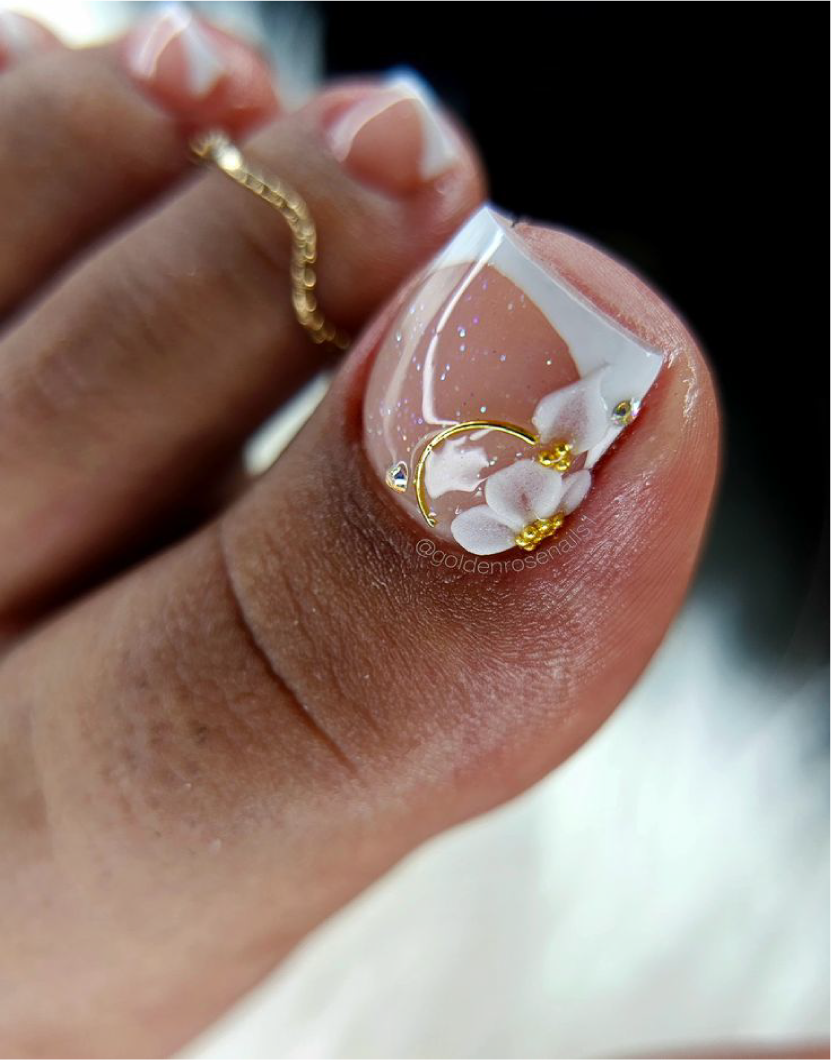 Retiro de Uñas